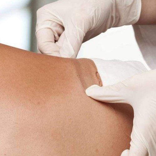 Enfermeira preparando material esterilizado para curativo pós-cirúrgico em Sorocaba